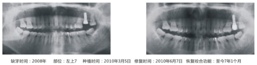临床病例5