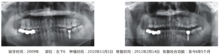 临床病例8