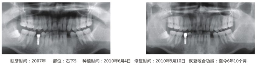 临床病例7